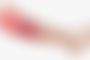 ¿TIENE SOLUCION LA TENDINITIS?