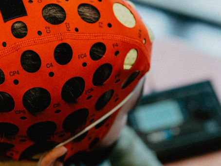 tDCS/NEUROMODULACIÓN