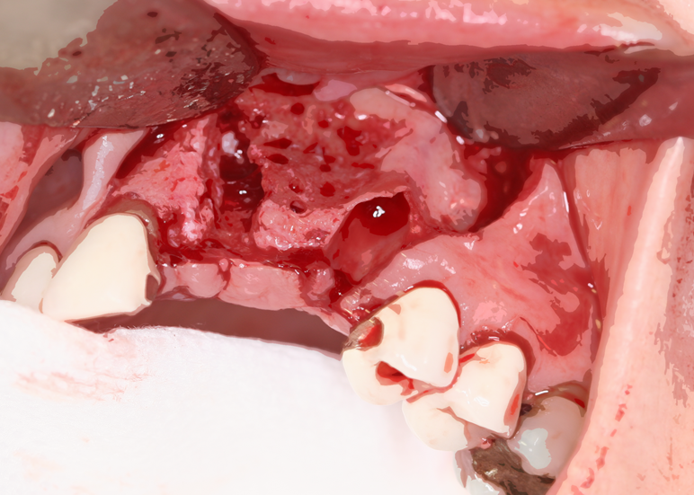 Deficient bone