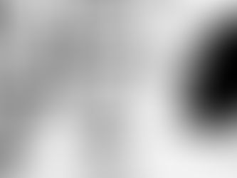 Spikey NeuroDivergent profile.