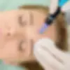 Rejuvapen Microneedling