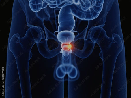 Cancer de la prostate, le saviez-vous ?