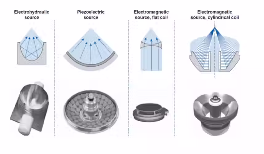 Shockwave therapy types