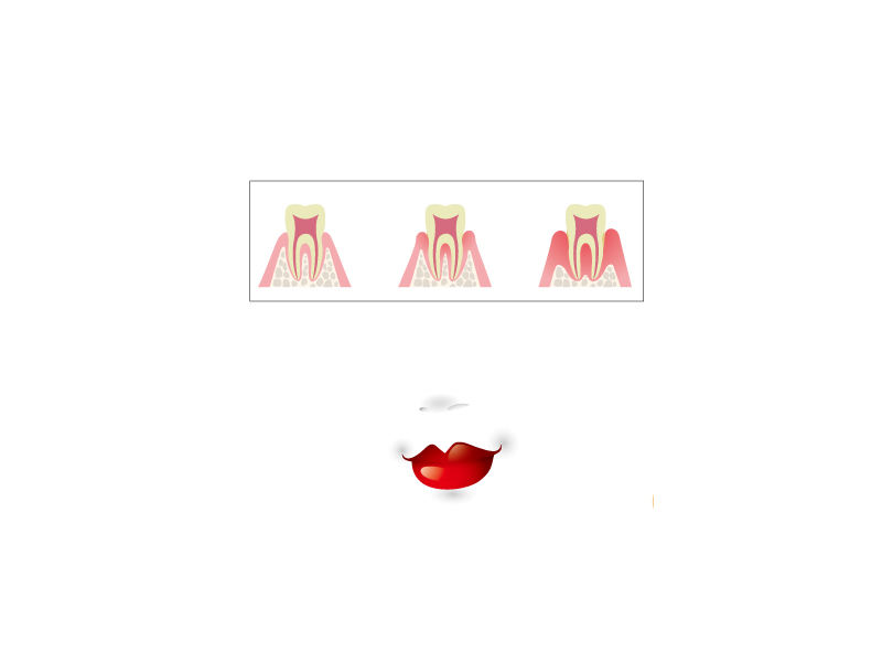 2Dr01n005-1.png