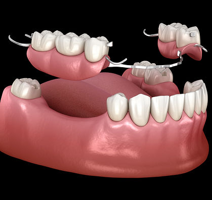 Dentures.jpeg