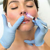 Cosmetic injection .jpg