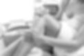 Laser hair removal
