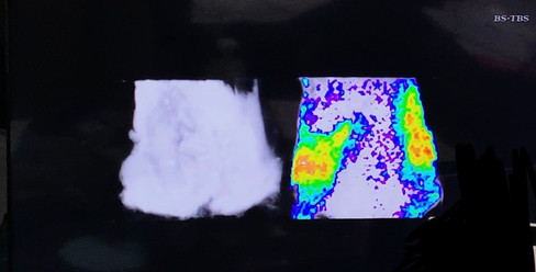 19 11 30 Tv出演 Nutrition