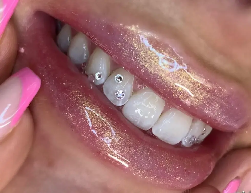 Formation bijoux dentaires