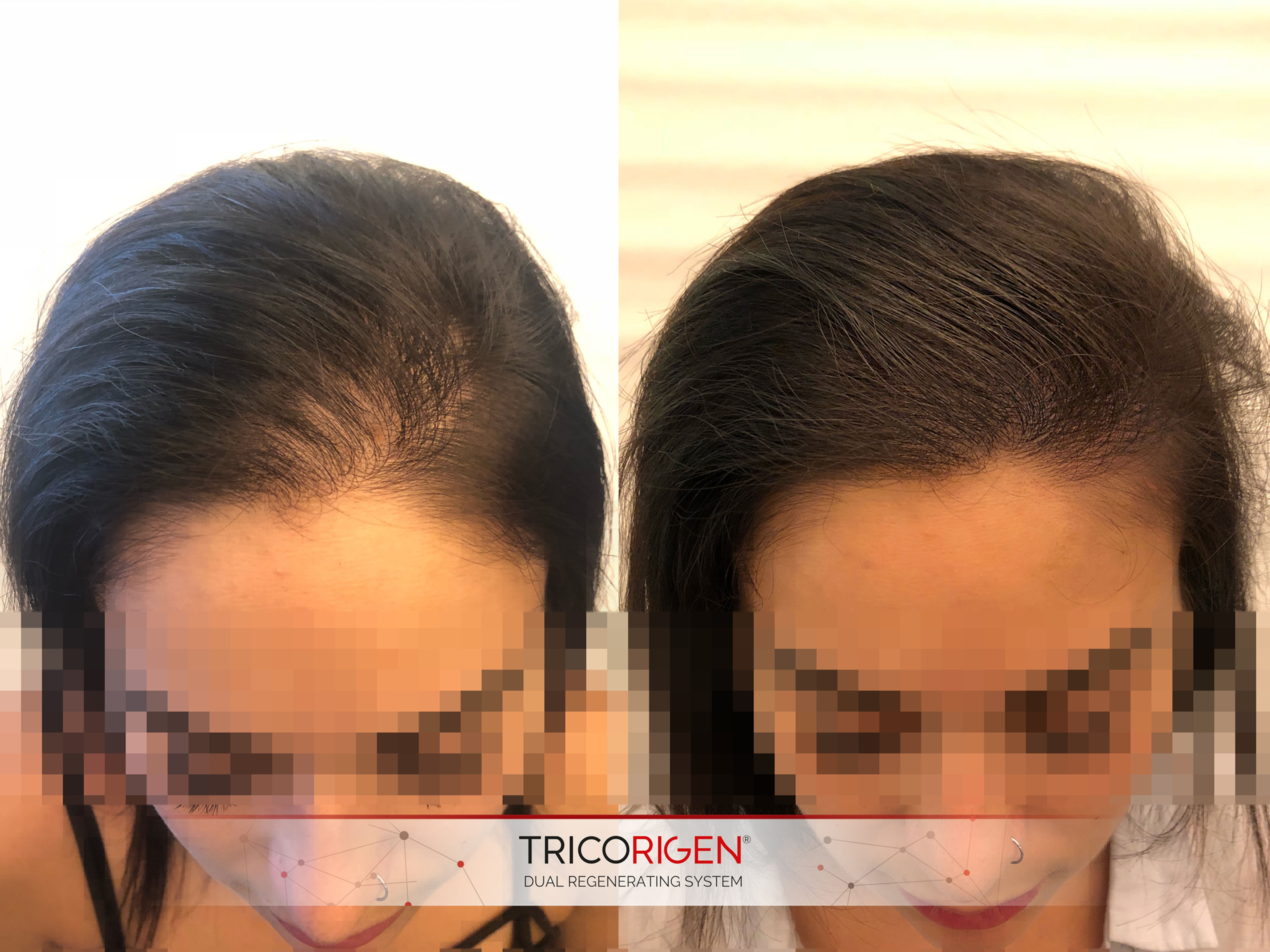 Formation Tricorigen avec Toni Belfatto