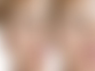 Microneedling pour les esthéticiennes : ce que dit la loi en Suisse