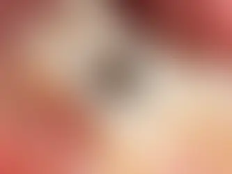 Fogászati tömőanyagok típusai-Melyik a legjobb választás?