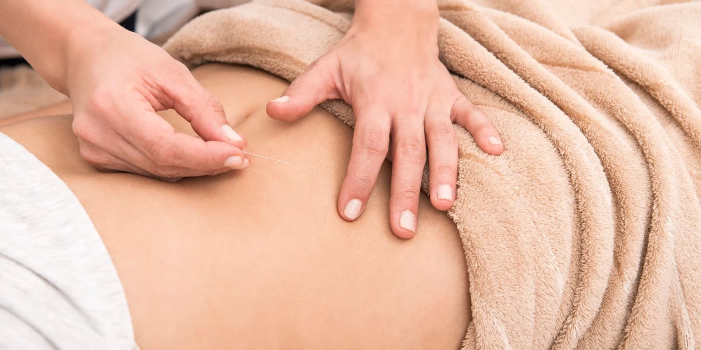 AcupunctureForFertility_ArticlePageDesktop.png.webp