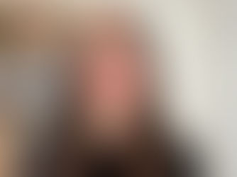 Amy Shaw, PA, dementia care expert, speaking in a video about why dementia is often missed and how caregivers notice changes first.