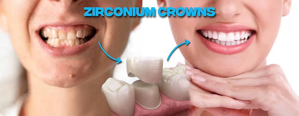 zirconium-crown-before-and-after