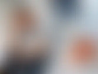 Médico en cirugía con sonda láser dentro de una próstata modelo. Al fondo, dos cirujanos de azul en quirófano. Imagen de próstata arriba.