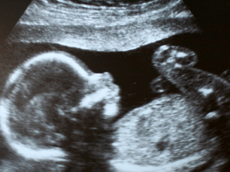 TERAPIE CON LUCE ROSSA & fertilità