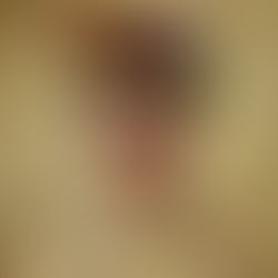 To hair or not to hair?