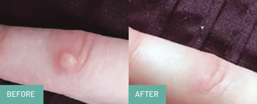 BEFOREAFTER5.gif