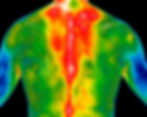 Medical thermography scan of the back and spine showing temperature distribution throughout the upper and lower back.