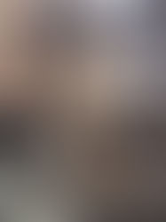 Failure Analysis of Metallic Components 