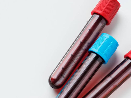 Hemograma: exame mais solicitado pela comunidade médica é alvo de estudo
