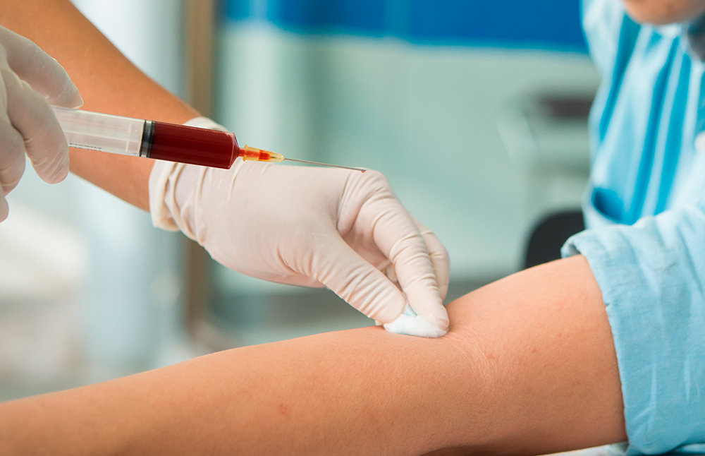 Exame de Proteína C reativa (PCR) para que serve? Exame de Proteína C reativa (PCR) para que serve?