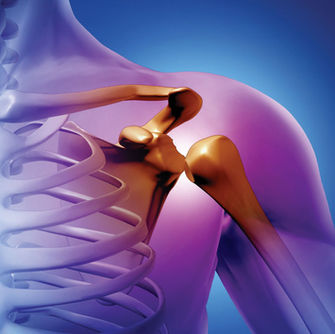 Polimialgia reumática e arterite de células gigantes