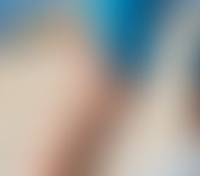 Venas varicosas Parte III