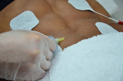 Gracyanne em procedimento