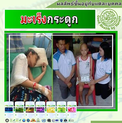 รักษามะเร็ง