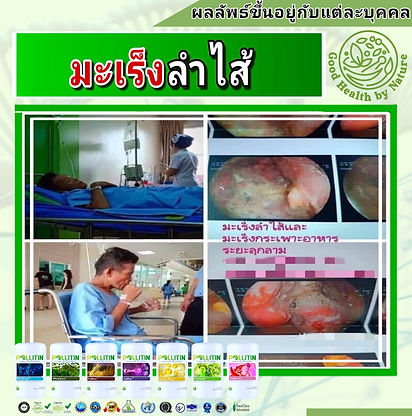 รักษามะเร็ง