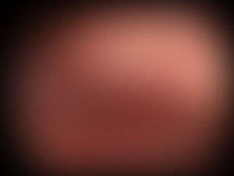 검진으로 왔지만 내시경 소견 확인 후 증상이 확인되는 경우