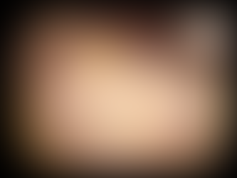 용종절제후 경계 양성, 육안적으로도 의심되어 짧은 추적, 재발/잔여 병변의 없음 확인; 소작의 응고효과 - 동대문구 답십리, 전농동, 우리안애 우리안愛 내과