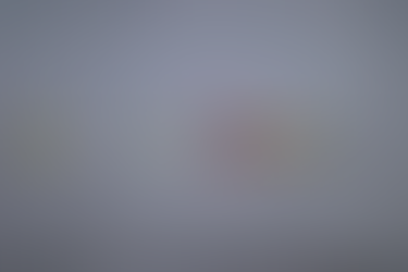 검진에서 요당 4+로 심한 당뇨인줄 알았으나.. 당뇨/고혈당이 아닌데 요당이 강양성, 판코니 증후군? (2) - 동대문구 답십리, 전농동, 우리안애 우리안愛 내과