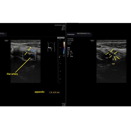 발열과 복통, 아랫배/치골상부 압통/반발압통, 골반염 의증, 초음파 소견은 없으며... 산부인과 의뢰 - 동대문구 답십리, 전농동, 우리안애 우리안愛 내과