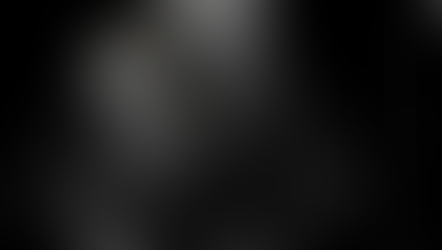 복부 담낭 초음파; 갑자기 발생하여 하루동안 지속되는 우상복부 통증, 담낭 오니 (sludge) 로 가득차고 팽대한 담낭 소견