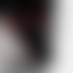 폐포음도 뚜렷하지 않고, 흉부소견도... 그러나, 임상적 모습은 진행하는... 흉부촬영의 복기 - 동대문구 답십리, 전농동, 우리안애 우리안愛 내과