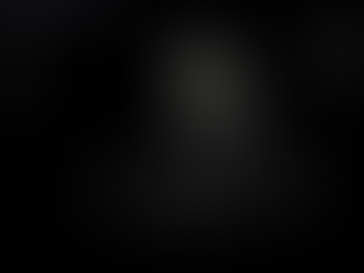 금주하지 못하는 알콜성 간경화 환자에서 드디어 복수가 발생, 미상엽의 지속적 비대도 인지됨 - 동대문구 답십리, 전농동, 우리안애 우리안愛 내과