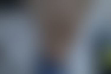 탈모성지에서 1년처방?? 미녹시딜 부종/체중증가를 강하게 의심 - 동대문구 답십리, 신대방동, 우리안애 우리안愛 내과