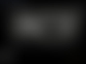 각진형 경계(angular margin)를 가지는 유방 종괴 - 동대문구 답십리, 장안동, 우리안애 우리안愛 내과