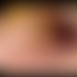 위소매절제술 배경에서 식사하면 구토, 구조적 소견은 없으니 일과성? 지나가는 위장염? - 동대문구 답십리, 전농동, 우리안애 우리안愛 내과