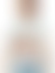 30대 면역 관용기에서 진행성 간암 진단 받은 경우, 보균자에서 간암 검진의 필요성