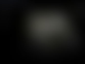 우상복부 통증/압통, 게실염을 의심하여 초음파로 힘들게 확인 - 동대문구 답십리, 전농동, 우리안애 우리안愛 내과