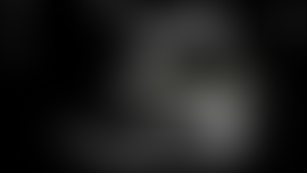 담낭/담석 질환의 증상 및 초음파 소견의 스펙트럼이 넓다. 명확한거에서 미묘한 (2)... 놀라운반응! - 동대문구 답십리, 장위동, 우리안애 우리안愛 내과