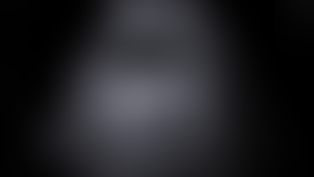 복부, 담낭 초음파; 반복되는 담낭산통, 다수의 담석이 일렬