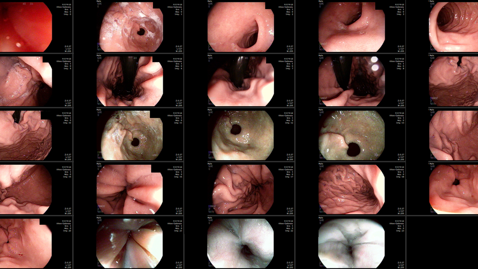 쓰리면서도 쥐어짜기도.. 궤양일지도 설명듣고 위내시경 위해 방문 - 동대문구 답십리, 장안동, 우리안애 우리안愛 내과