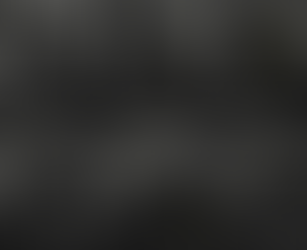 시시각각 변화하는 갑상선 모습, 하시모토 갑상선염의 활동기? 겹친 무통성 갑상선염 현상일지... - 동대문구 답십리, 제귀동, 우리안애 우리안愛 내과