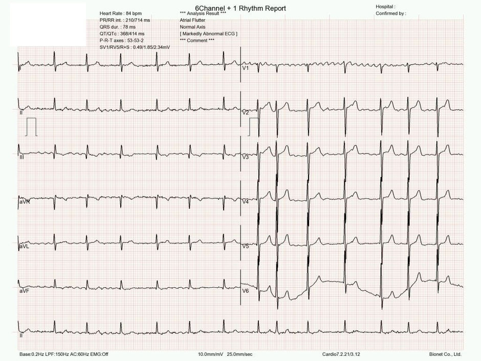 증상이 없다고 높은 혈압 방치하다가... 200 이상으로 방문 - 동대문구 답십리, 용답동, 우리안애 우리안愛 내과