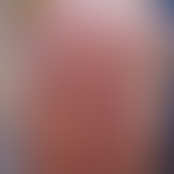 방관하는 당뇨 배경에서 매우 심한? 대상포진의 발생 - 동대문구 답십리, 전농동, 우리안애 우리안愛 내과